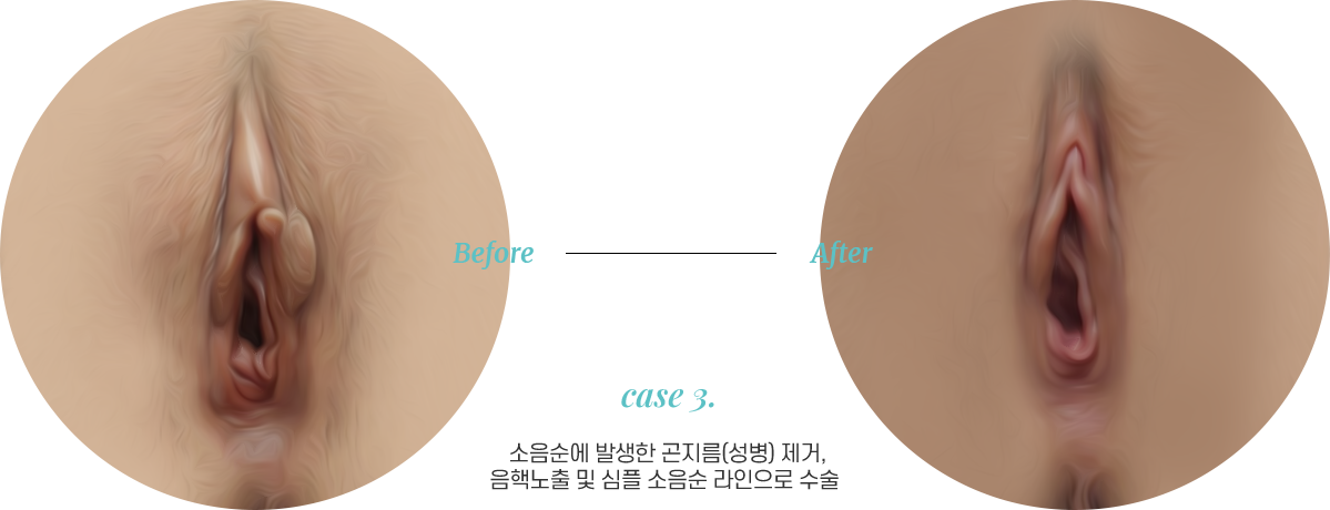 전후사진3