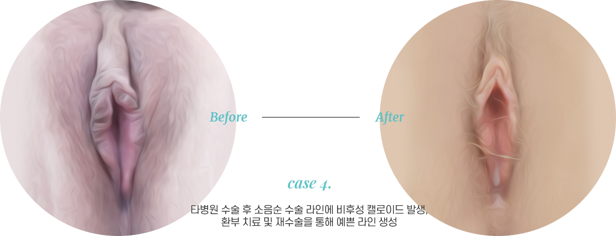전후사진4