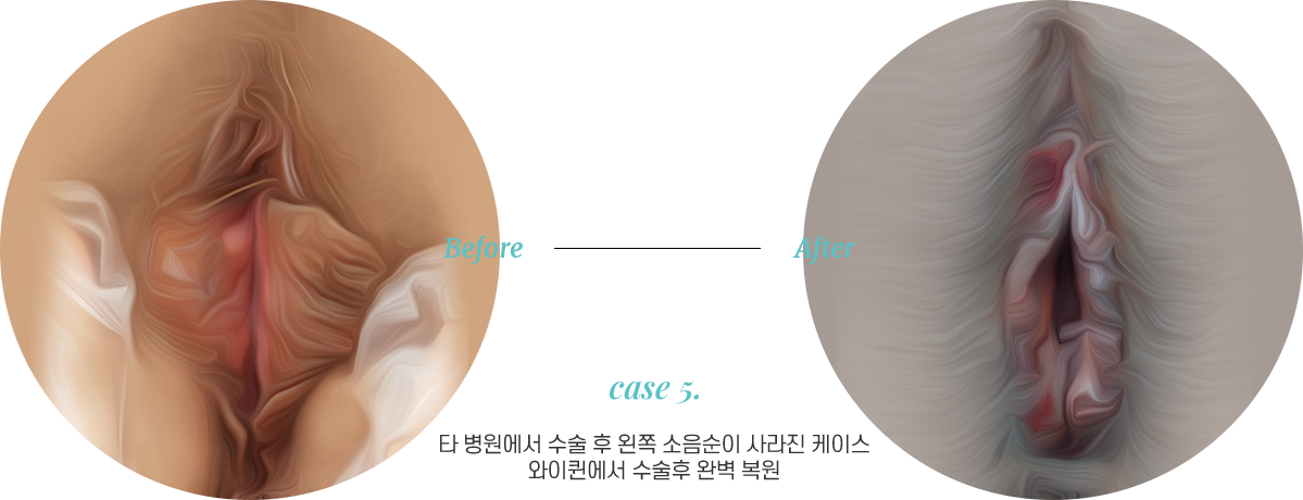 전후사진5