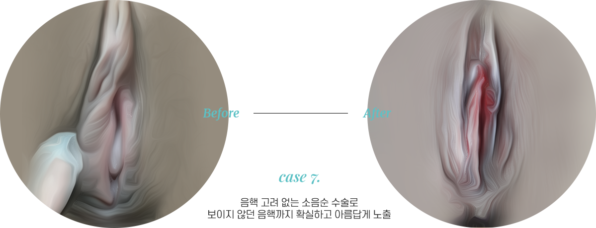 전후사진7